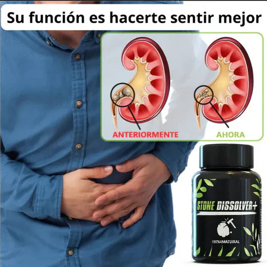 💚 STONE DISSOLVER™ - Disuelve Cálculos, Alivia Dolor y Mejora el Flujo Urinario
