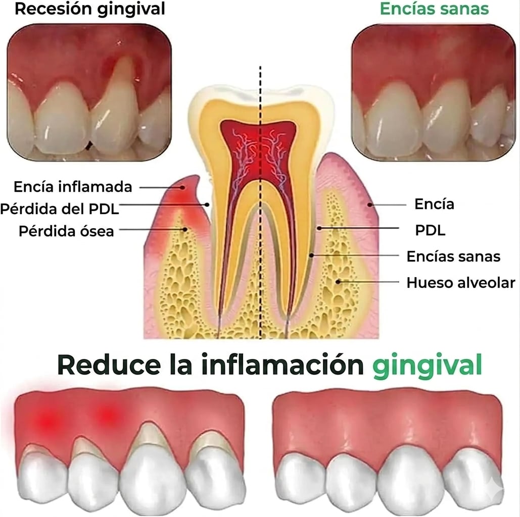 🦷 REPARA CARIES, ALIVIA ENCÍAS INFLAMADAS + ENVÍO GRATIS