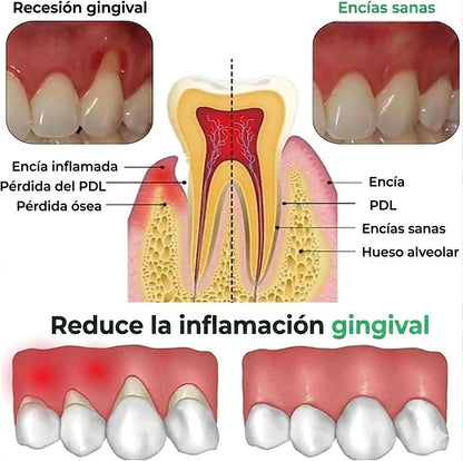 🦷 REPARA CARIES, ALIVIA ENCÍAS INFLAMADAS + ENVÍO GRATIS