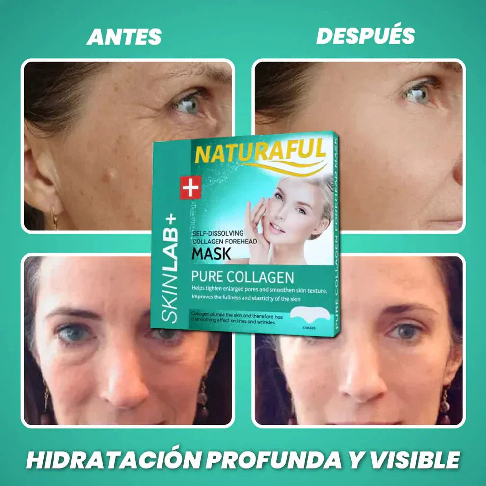 NaturalFul® Parches De Colágeno Absorbentes Milagrosos ✨❤️ + ENVÍO GRATIS 🚚
