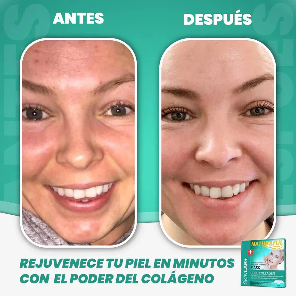NaturalFul® Parches De Colágeno Absorbentes Milagrosos ✨❤️ + ENVÍO GRATIS 🚚